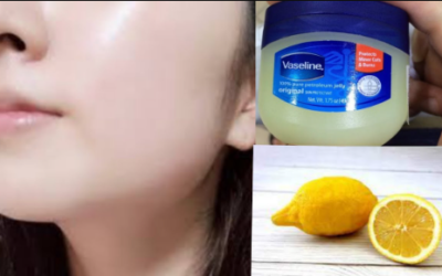 Unlock the Secret to Youthful Skin and Soft Lips with Vaseline and Lemon